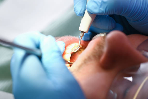 Best Emergency Dental Services for Seniors in Salineville, OH