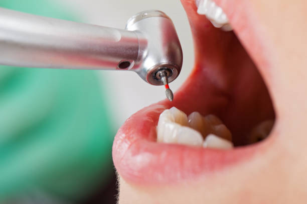 Best Emergency Dental Care for Abscessed Tooth in Salineville, OH